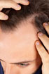 Problmy s kvalitou vaich vlas? Toto jsou ty nejznmj